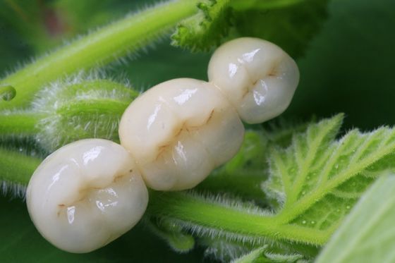 Tất cả Mão răng sứ Zirconia