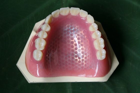 Khung kim loại in 3D Bộ xương răng giả một phần