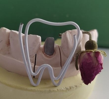 Trụ răng kim loại và lõi sau khi điều trị nội nha