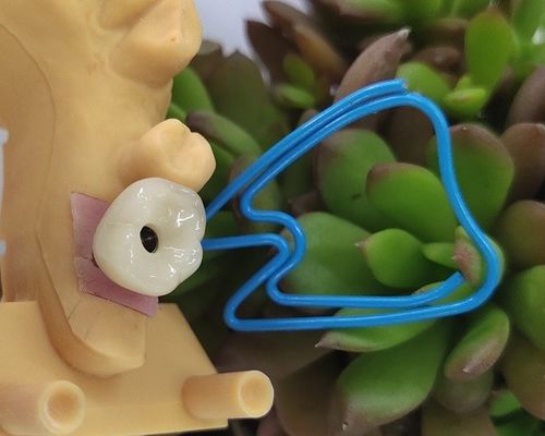 Máy cấy ghép răng một răng OSSETEM Mức độ cố định