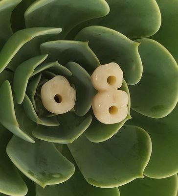 Vương miện cấy ghép nha khoa Endosseous