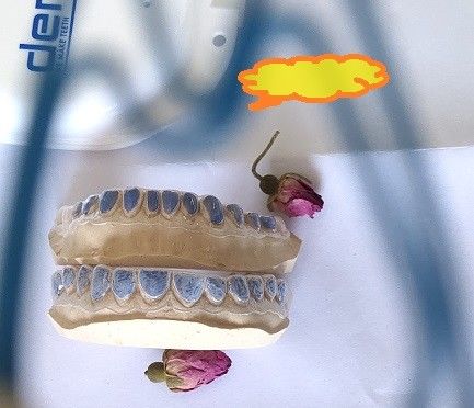 Khay tẩy trắng ISO13485 tùy chỉnh để làm trắng răng