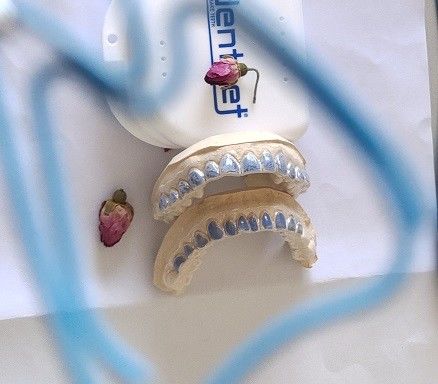 Khay tẩy trắng ISO13485 tùy chỉnh để làm trắng răng