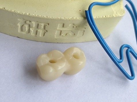 Thiết kế CAD CAM Nha khoa In 3D
