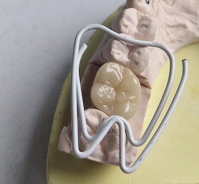 Răng sứ khối Zirconia