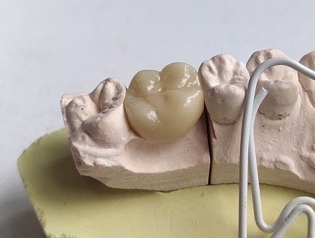 Răng sứ khối Zirconia