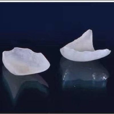 Nhìn tự nhiên Tất cả các Veneers sứ Bọc răng sứ EMAX