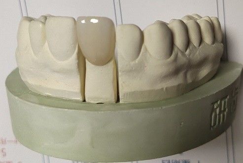 Zirconia Blocks Nha khoa In 3D bằng CAD CAM Phay