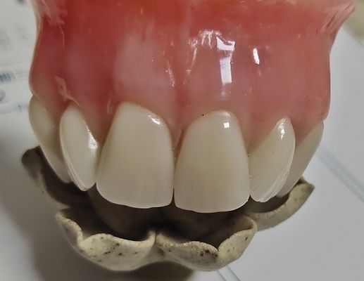 Thẩm mỹ Răng giả toàn bộ Răng giả bằng nhựa acrylic lạnh