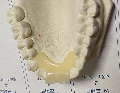 Răng giả vô hình bằng Nylon đàn hồi mềm