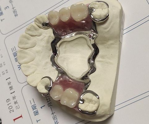 Vòm hàm trên Co Cr hợp kim Khung kim loại cho răng giả một phần