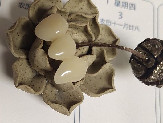 Vương miện composite dựa trên nhựa màu tự nhiên