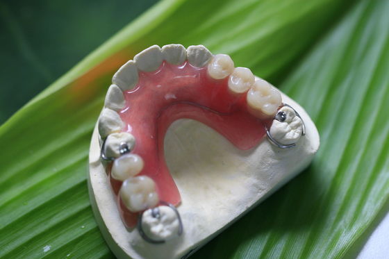 Hàm giả vô hình linh hoạt một phần cho răng trước