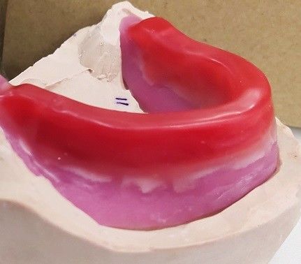 Khối hồ sơ nha khoa Trushine cho các răng giả hoàn chỉnh cuối cùng