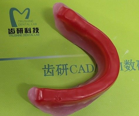 Đăng ký Cắn vành sáp nha khoa