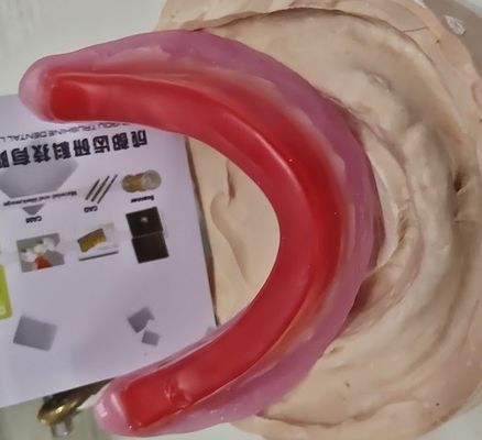 Đăng ký Cắn vành sáp nha khoa