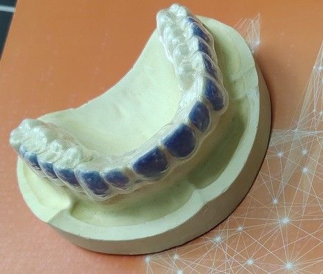ISO13485 Thuốc tẩy trắng răng bảo vệ cho vết ố khói