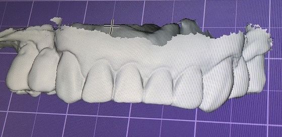 Kỹ thuật số 3D Mock Up Răng Các sản phẩm nha khoa khác