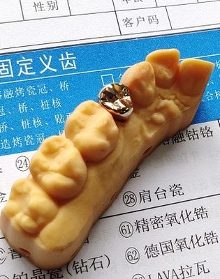 Thể hình tốt Vương miện nha khoa hợp kim vàng quý giá