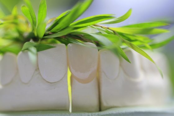 Bọc răng sứ thủy tinh vĩnh viễn tự nhiên cho răng trước