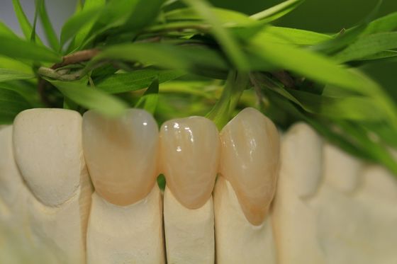 Nha khoa giả Toàn bộ Zirconium Oxide Crown Phòng thí nghiệm nha khoa thiết kế 5 sao