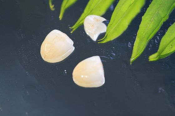 Vương miện nha khoa EMAX tự nhiên