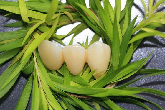 Vương miện nha khoa EMAX tự nhiên