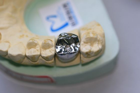 Đúc đầy đủ hợp kim kim loại cơ bản Vương miện nha khoa