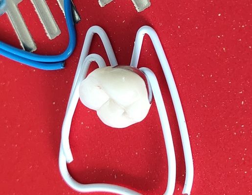 Phòng thí nghiệm PFM Vương miện nha khoa In 3D Cầu răng Vương miện