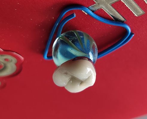 Phòng thí nghiệm nha khoa Sản phẩm CAD CAM PFM Bọc răng sứ kết hợp kim loại