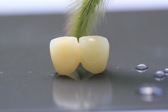 Khuôn khổ in 3D PFM Phòng thí nghiệm nha khoa Vương miện cho nha khoa