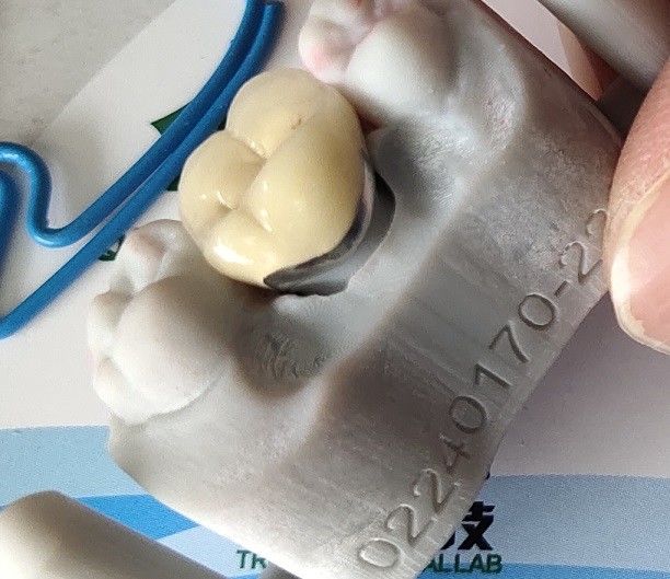 Phòng thí nghiệm nha khoa Sản phẩm CAD CAM PFM Bọc răng sứ kết hợp kim loại