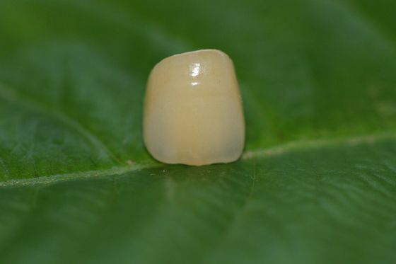 Phòng thí nghiệm thiết kế nha khoa Toàn sứ ISO13485 Vương miện nha khoa Zirconia cho răng trước